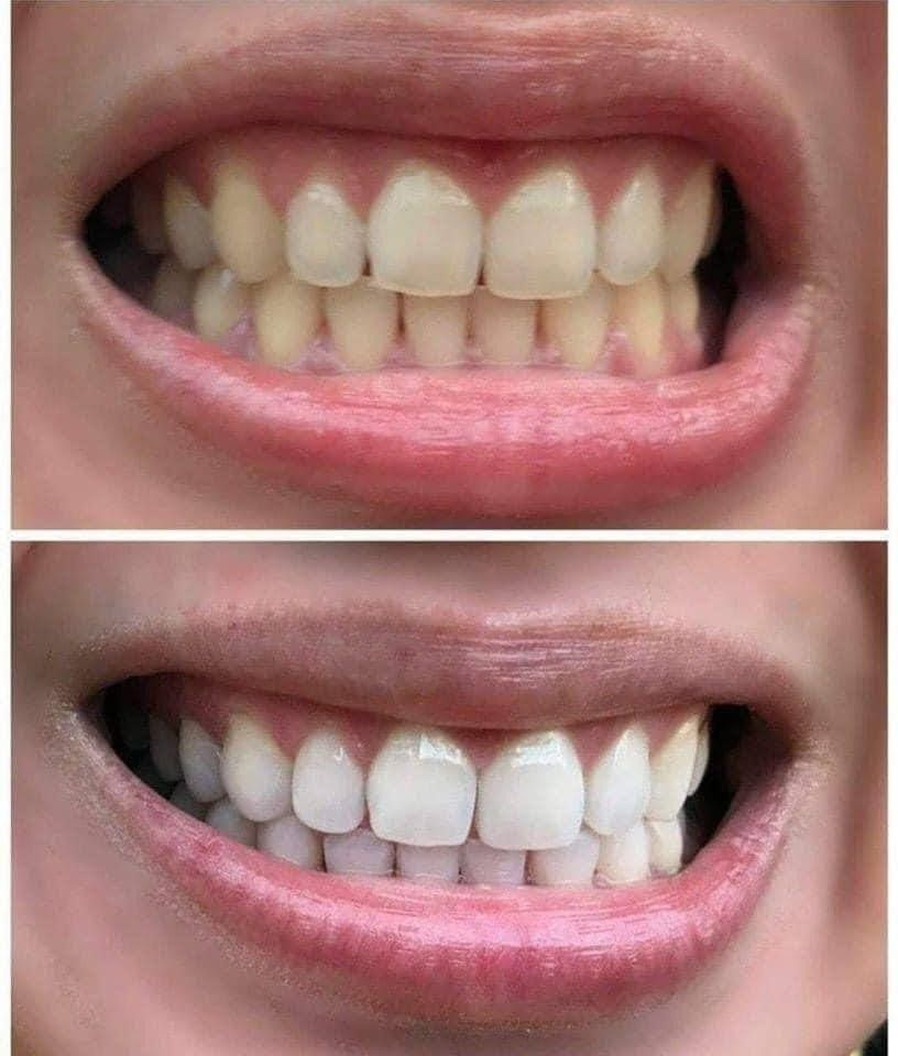 Glow™ Advanced whitening Tooth Powder